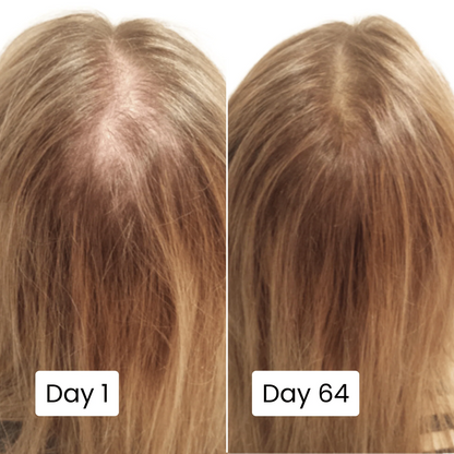 Scalpy Hair Growth Serum Original Limited Time Deal With Free Home Delivery All Over Uae