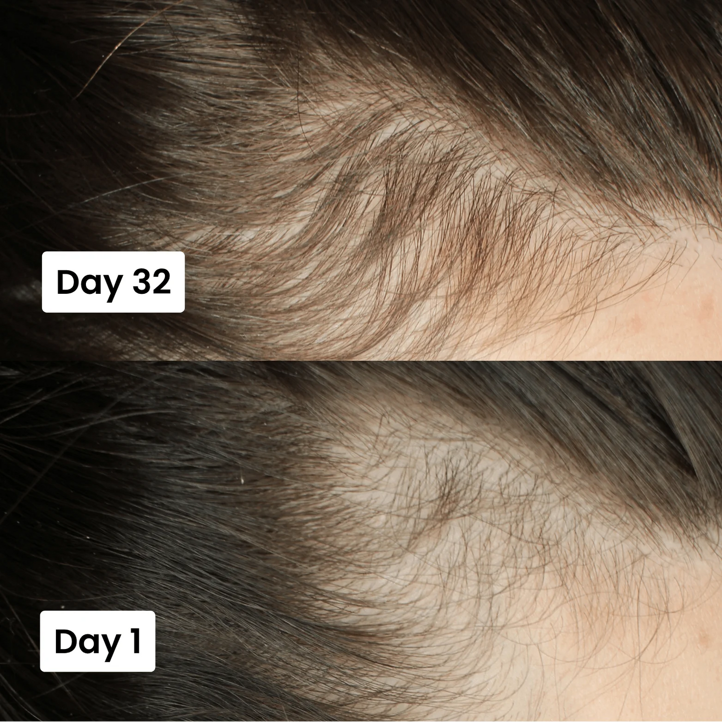Scalpy Hair Growth Serum Original Limited Time Deal With Free Home Delivery All Over Uae